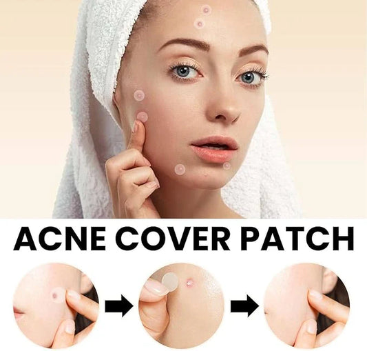 AcniFix™ Acne Cover Patch (72 Pieces)